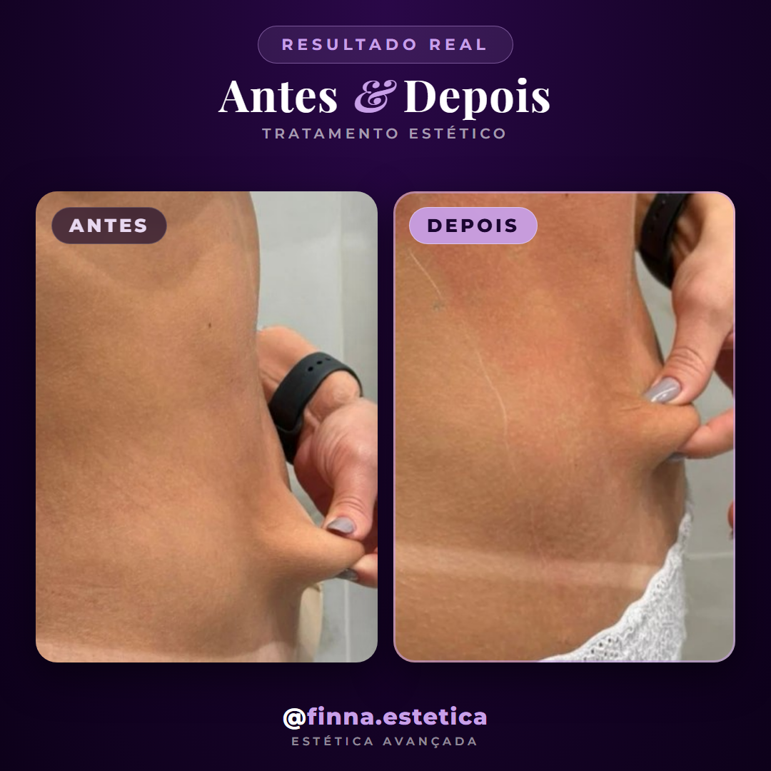 Estética corporal
